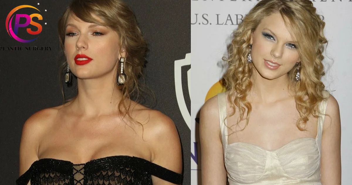 Has Taylor Swift Had Any Plastic Surgery
