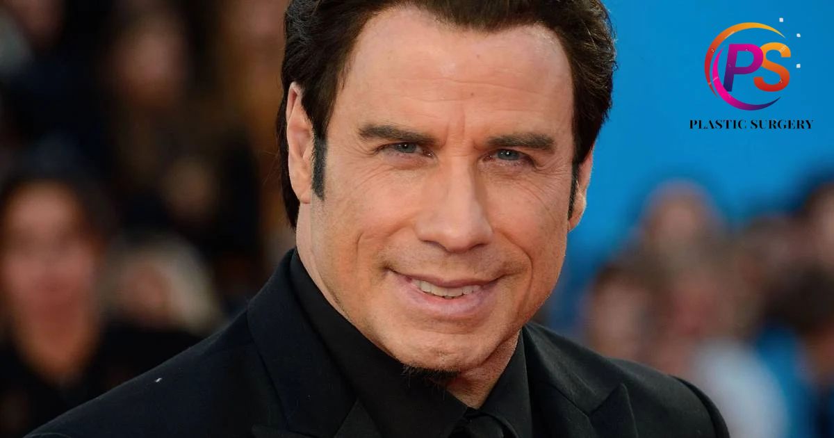 Has John Travolta Had Plastic Surgery?