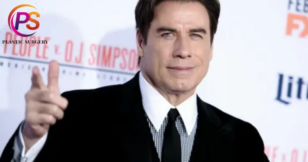 Rumored Cosmetic Surgeries That John Travolta Might Have Had