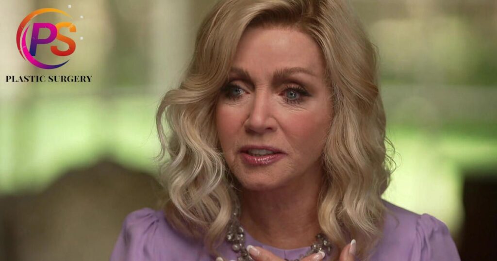 What age is Donna Mills?