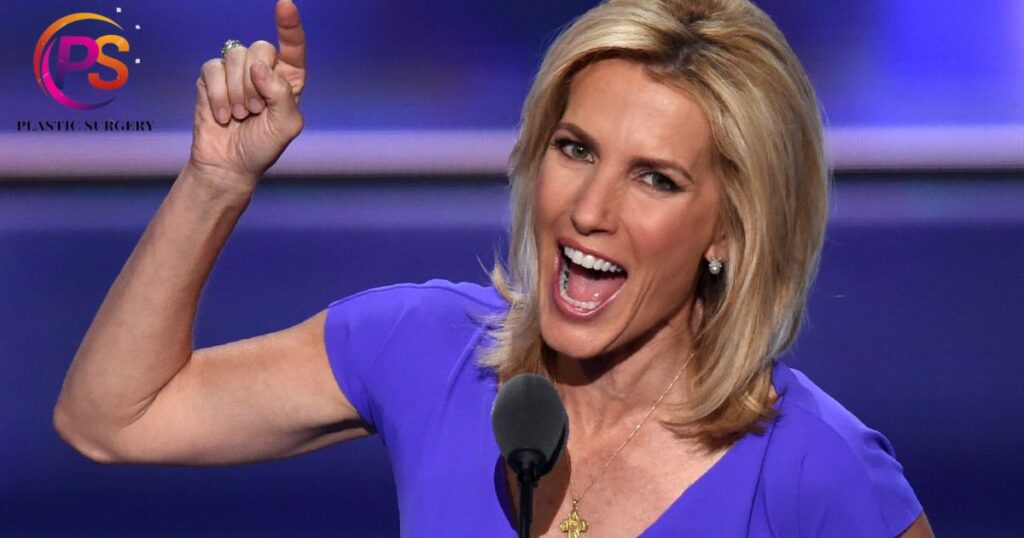 What Happened To Laura Ingraham’s Face?