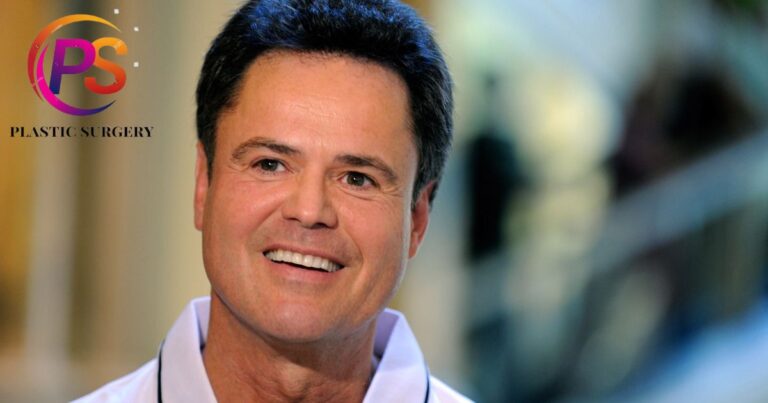 Did Donny Osmond Have Plastic Surgery?