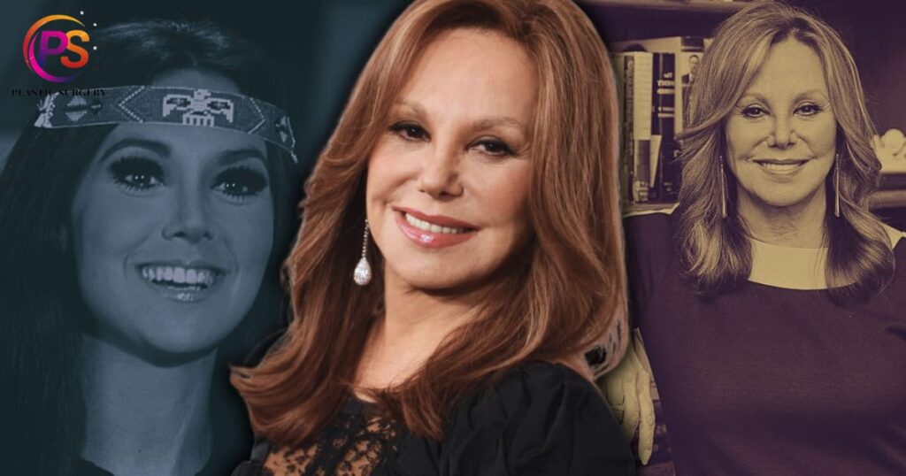 How Old Is Marlo Thomas Now?