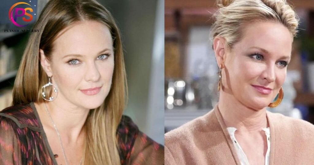 Sharon Case Plastic Surgery: What Fans Think of Her Glamorous Look?