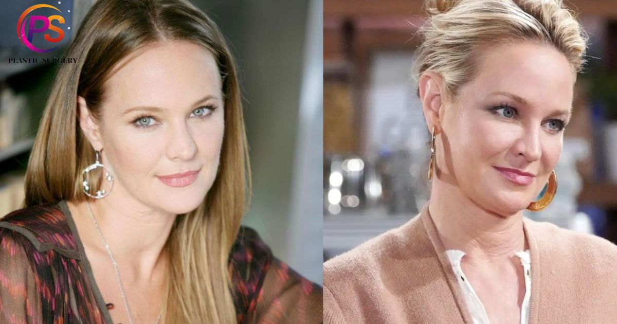 Sharon Case Plastic Surgery Is It Real or Are Fans Just