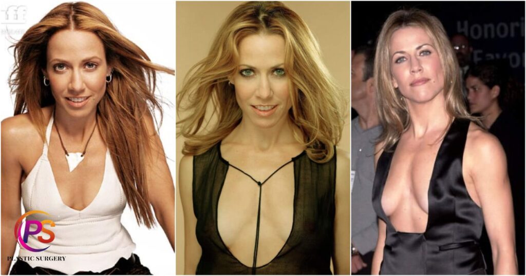 Sheryl Crow Plastic Surgery: Being a Mother Made Her Look More Beautiful?