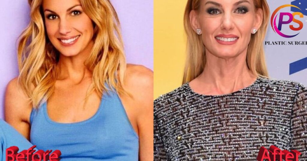 Faith Hill Plastic Surgery: Before and After Photos