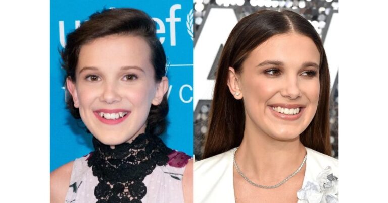 Everything You Need To Know About Millie Bobby Brown’s Plastic Surgery