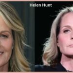 Helen Hunt Plastic Surgery