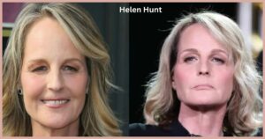 Helen Hunt Plastic Surgery