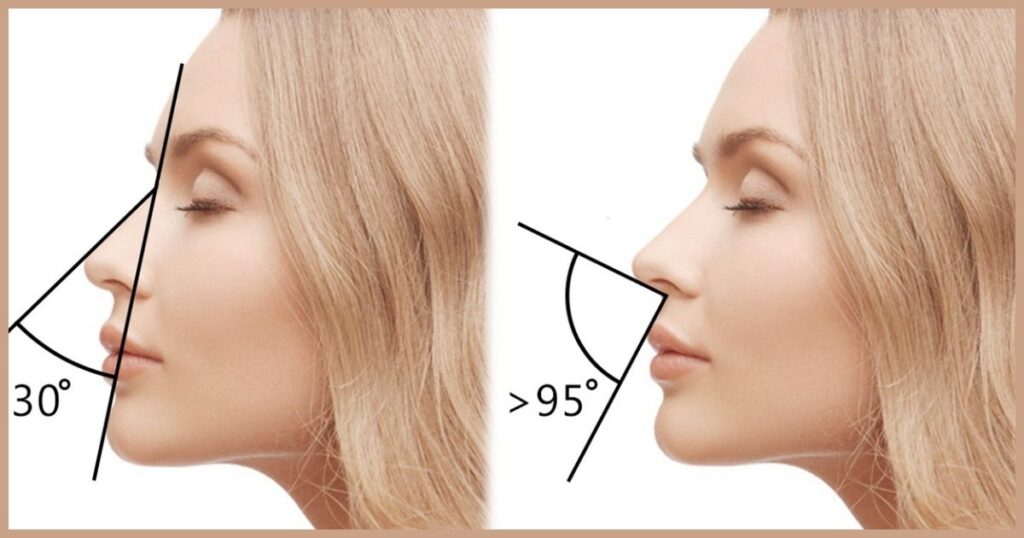 How to Determine Which Nose Line Suits You