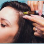 Prp Treatment For Hair Cost