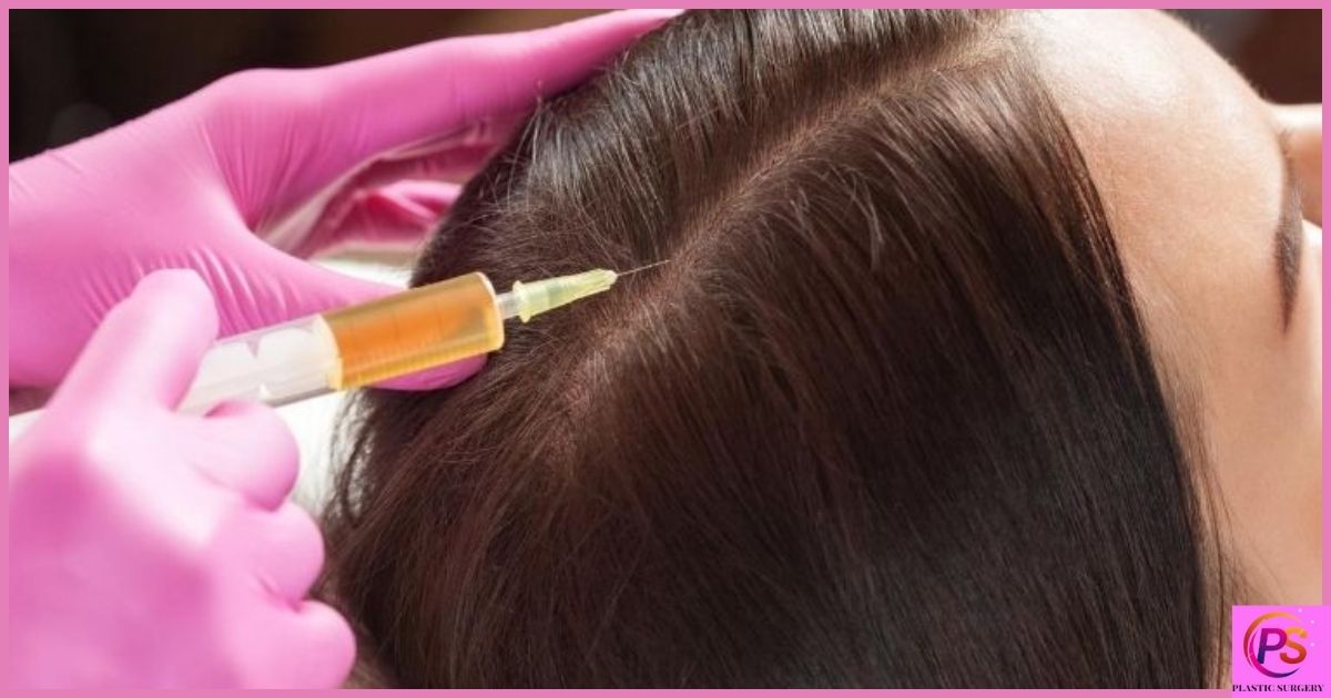 Understanding PRP Hair Treatment