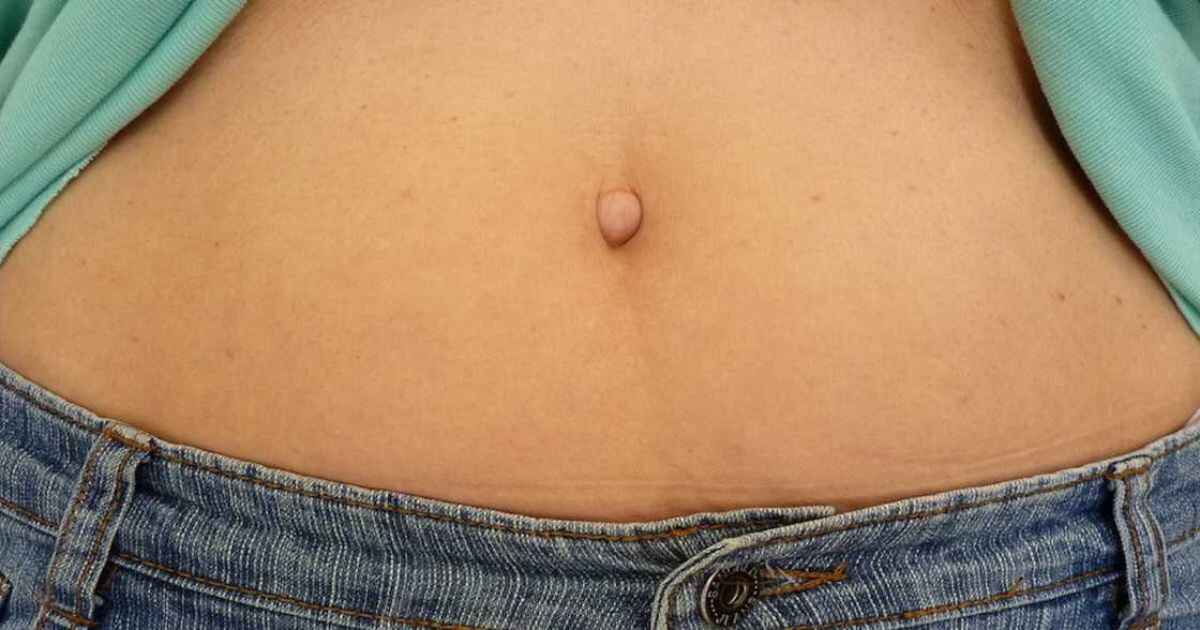 What Determines Belly Button Appearance